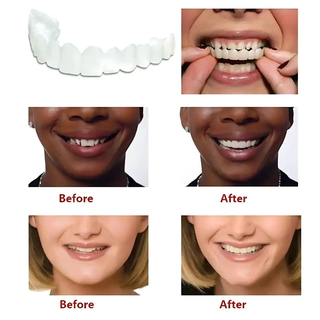 Next Gen Cosmetic Teeth Denture™