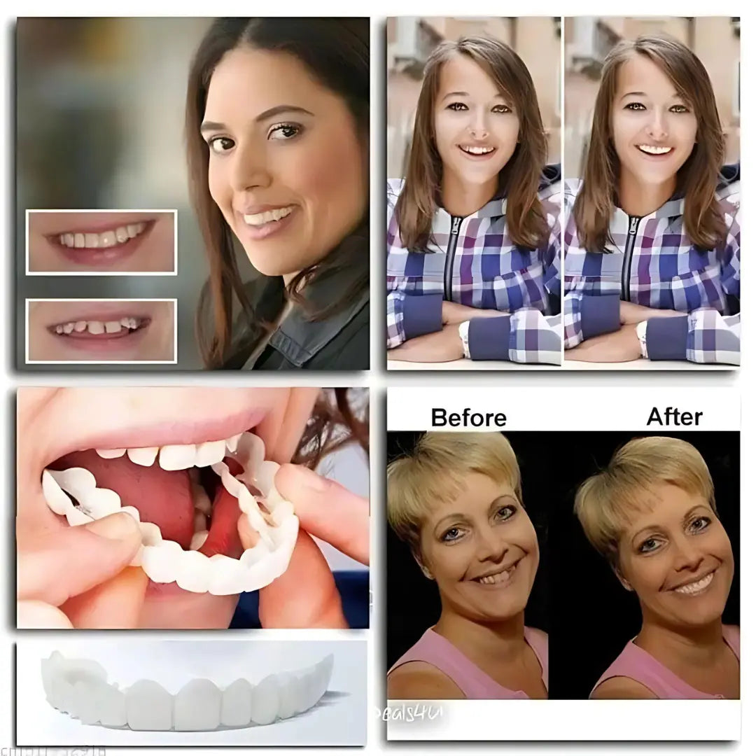 Next Gen Cosmetic Teeth Denture™