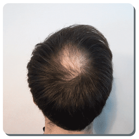 Toppik Hair Building Fibers™ - Color Black