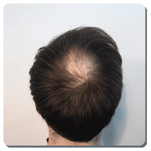 Load image into Gallery viewer, Toppik Hair Building Fibers™ - Color Black