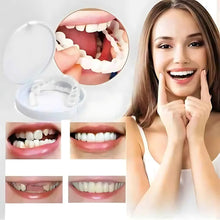 Load image into Gallery viewer, Next Gen Cosmetic Teeth Denture™
