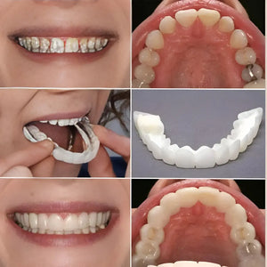 Next Gen Cosmetic Teeth Denture™