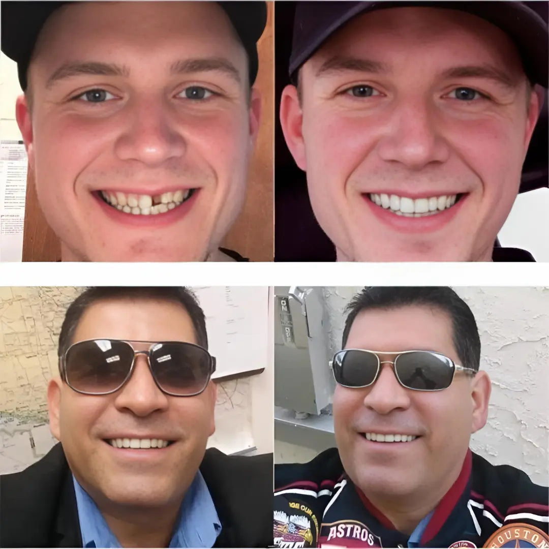 Next Gen Cosmetic Teeth Denture™