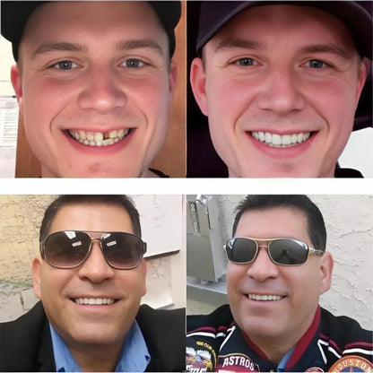 Next Gen Cosmetic Teeth Denture™