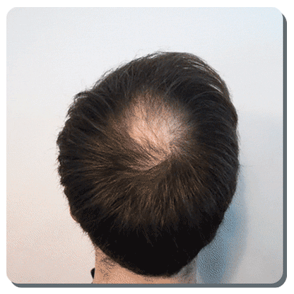 Toppik Hair Building Fibers™ - Color Black