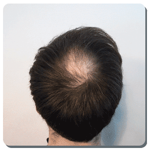 Toppik Hair Building Fibers™ - Color Black – Little Squirel